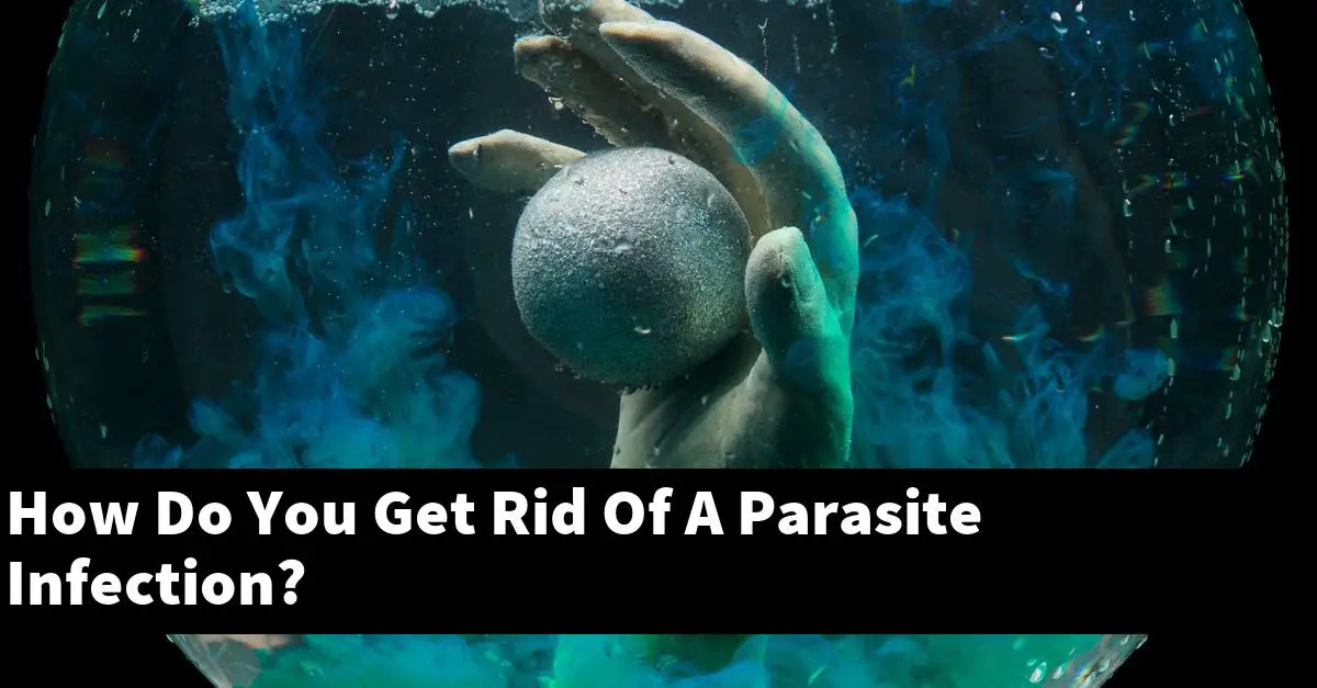 How Do You Get Rid Of A Parasite Infection?